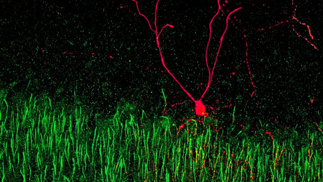 red cell image with green lines