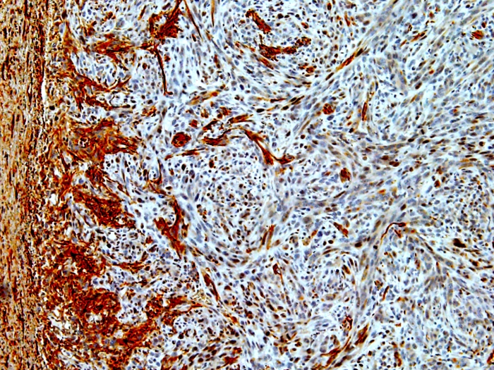 microscope cells glioma