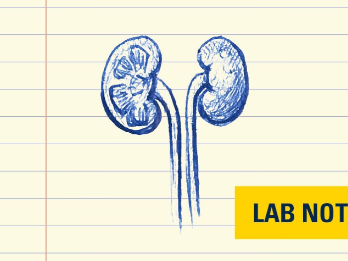 drawing in blue ink of kidneys on lined paper with lab note wording bottom right in blue with yellow background