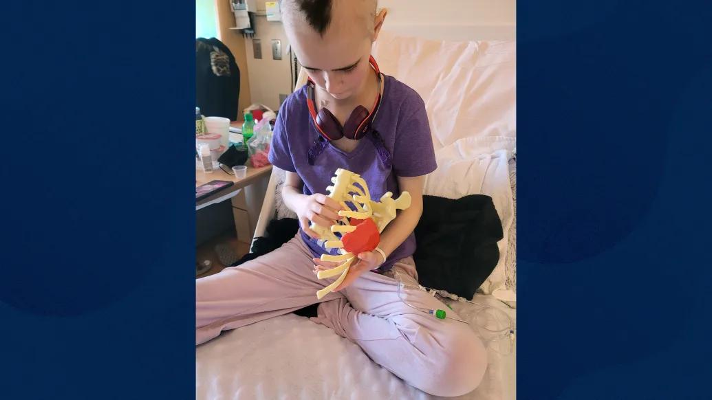3D metallic rib implants from Spain give teenage cancer patient a ...