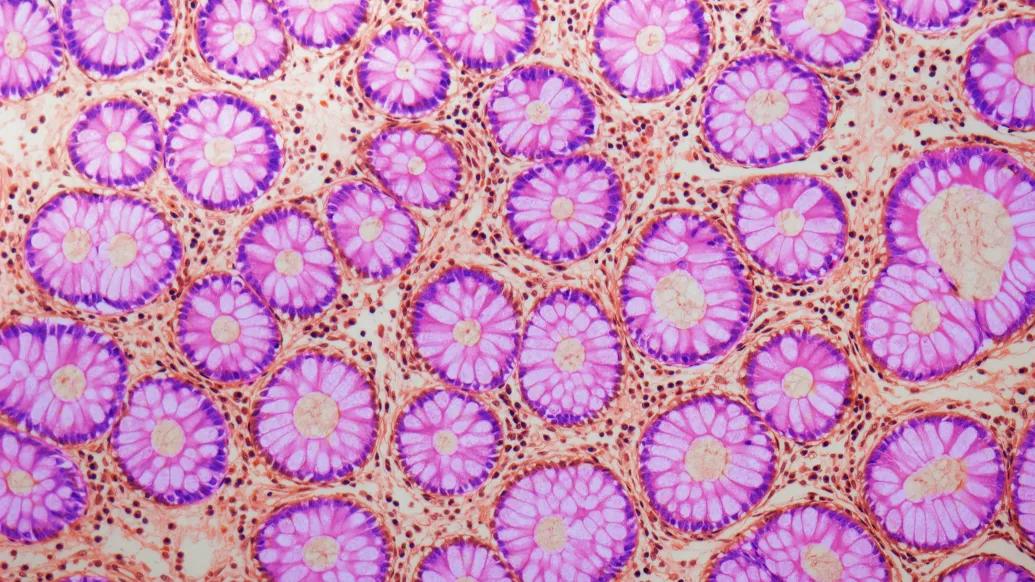 pink cells up close