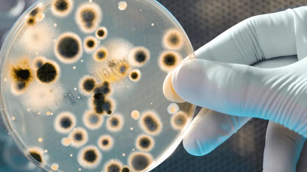 hand holding a microscope slide with microbes