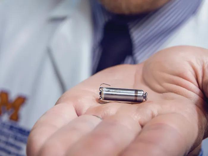 The smallest pacemaker fits in the palm of a hand