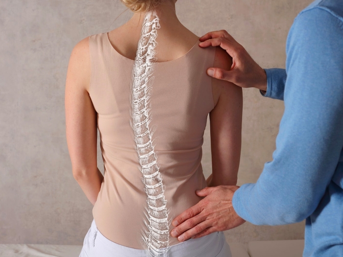 scoliosis see through back patient sitting 