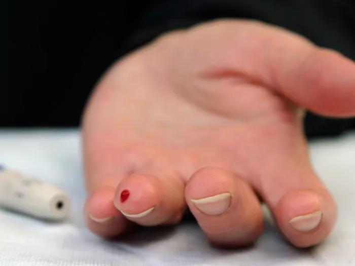 a hand on a table with a prick of blood on finger
