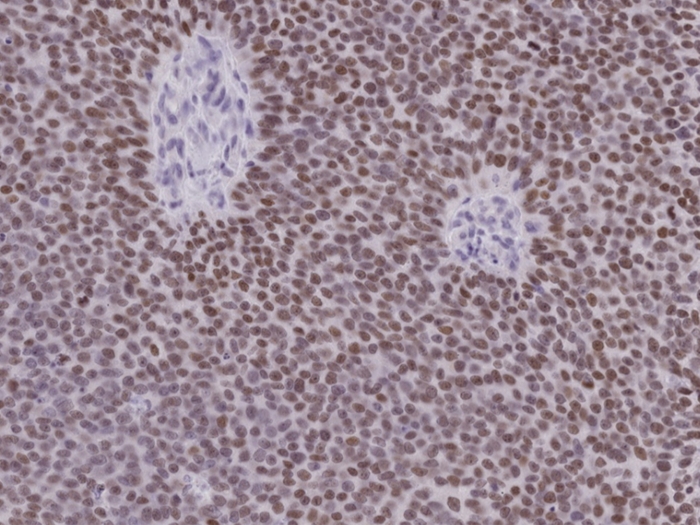 cells purple some lighter cells in white