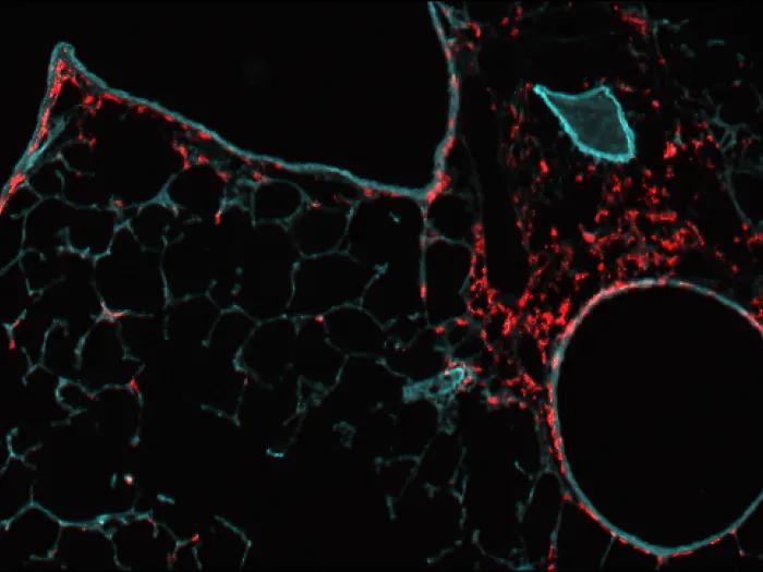 Lungs and T cell