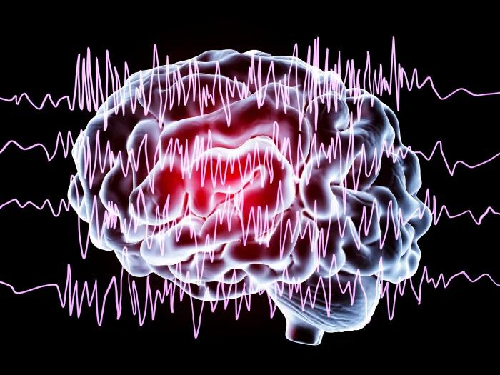 Signals across a background of the brain