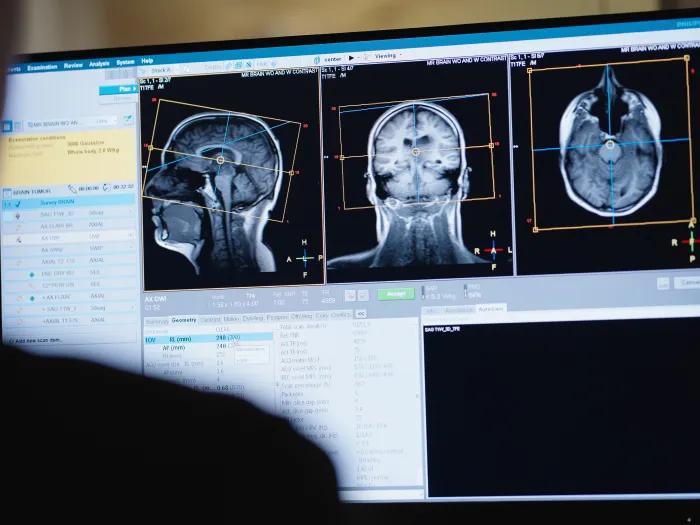 brain scan on computer
