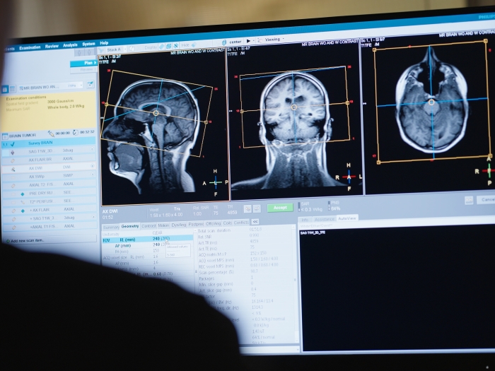 brain scan on computer