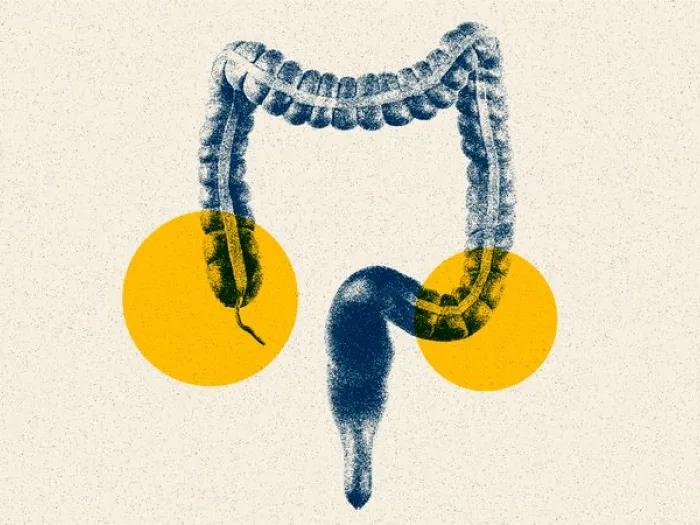 stomach intestine yellow spots navy blue
