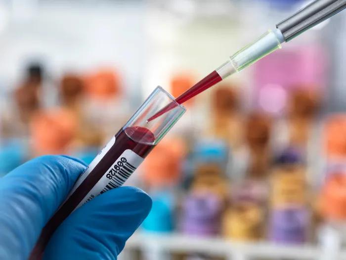blood vial blue gloves blurred background