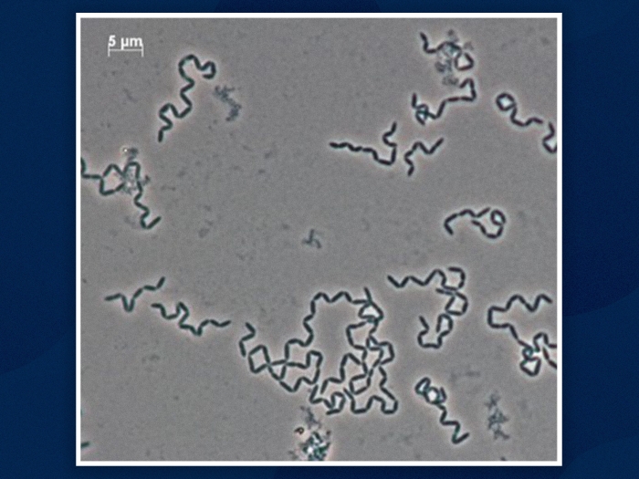 close up of cells moving in blue lines grey background under microscope