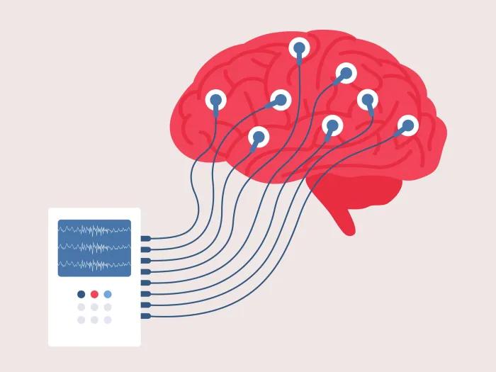 darker pink brain with electrodes from white device