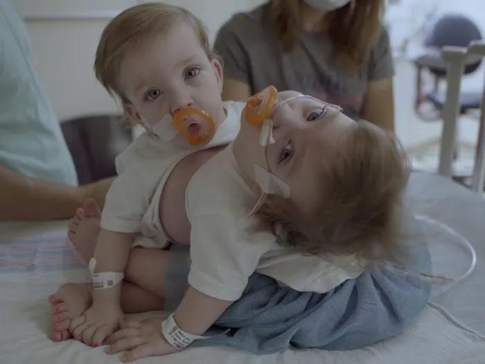 Conjoined twins sitting in baby crib