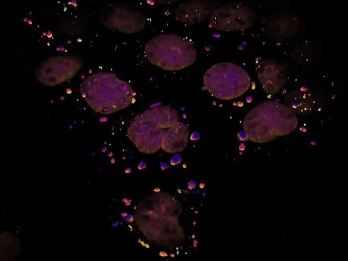 stress granules by the Moon Lab