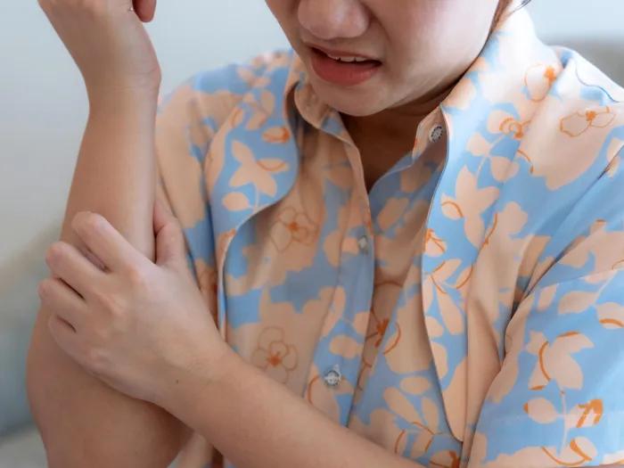 woman itching skin orange blue button down