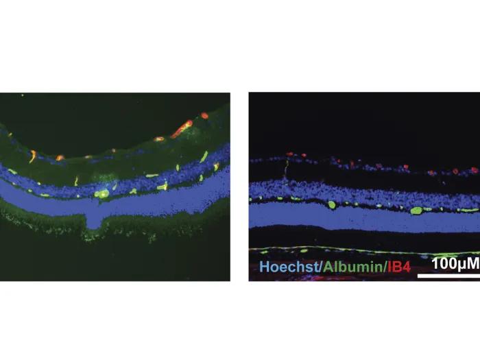 Research image of rat blood vessels before and after norrin treatment 