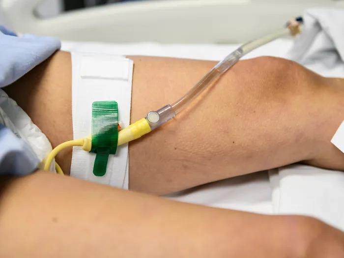 Catheterized hospital patient's leg