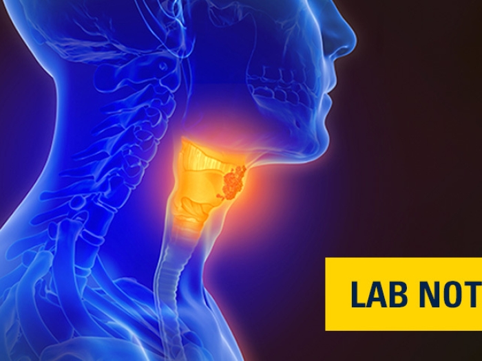 blue xray throat tumor lump with lab note written in blue with yellow overlay on bottom right