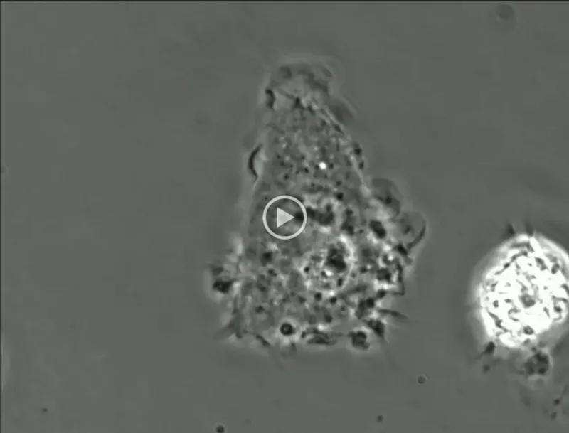 Photo of a microphage video