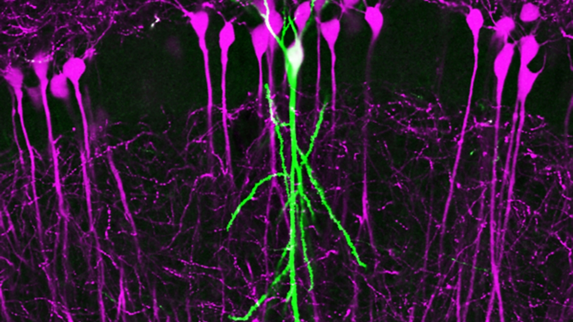 hippocampal Neuron genome 