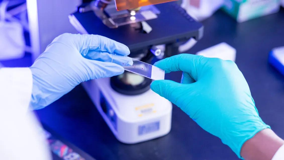 Lab member holding a sample to put under a microscope