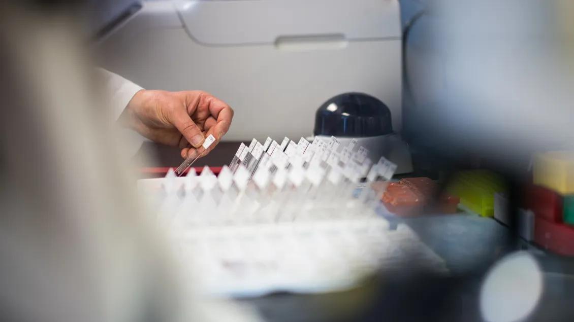 A person using medical lab equipment with glass slides