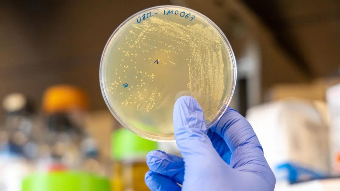A gloved hand holding a petri dish with bacterial colonies.
