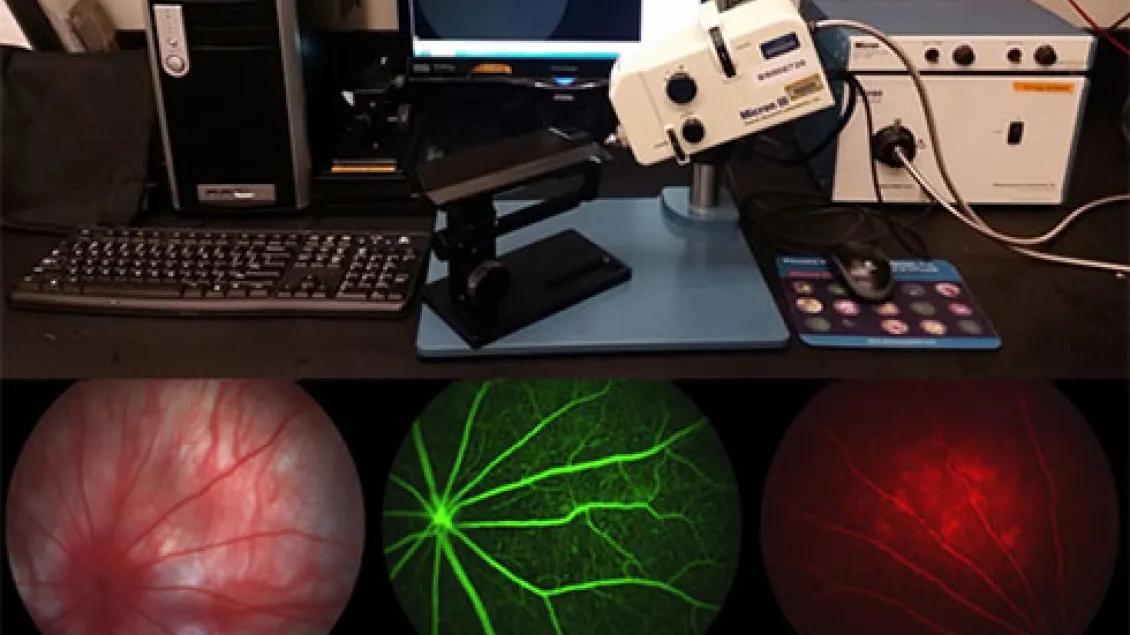 FA Phoenix with retina scans under the equipment image
