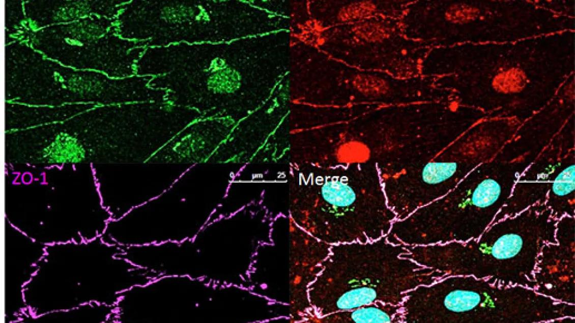 Cell imaging with four quadrants in green, red, purple and blue