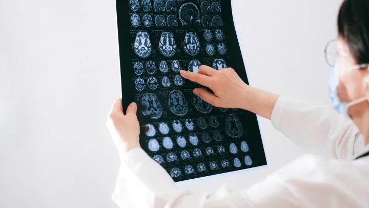 doctor pointing to brain scans