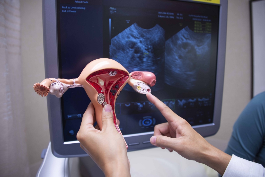 A doctor holds a model of the female reproductive system