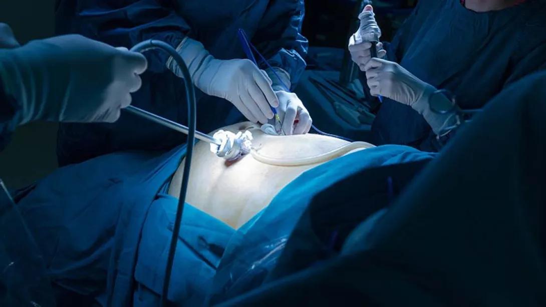 A close up of an operation in process