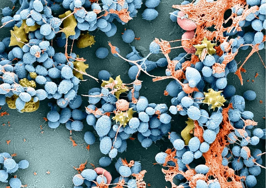 Candida auris