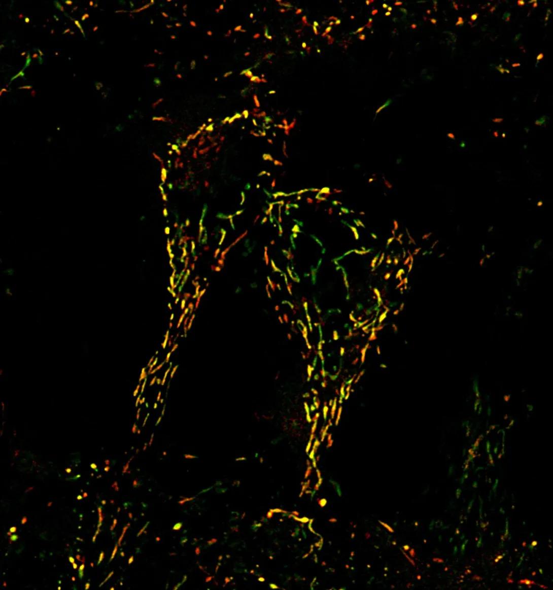 Super resolution imaging of mitochondria in mouse hippocampal neurons.