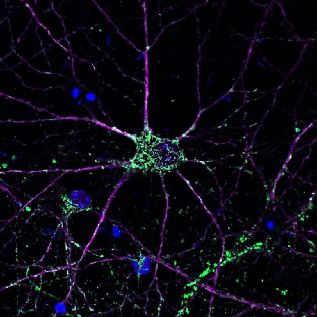Super resolution imaging of neurons in vitro. Cells are grown on silicone membranes for stretch injury that models TBI. Purple are neurons, green are mitochondria, blue are nucleus. (Image courtesy of Dr. Joseph Wider)