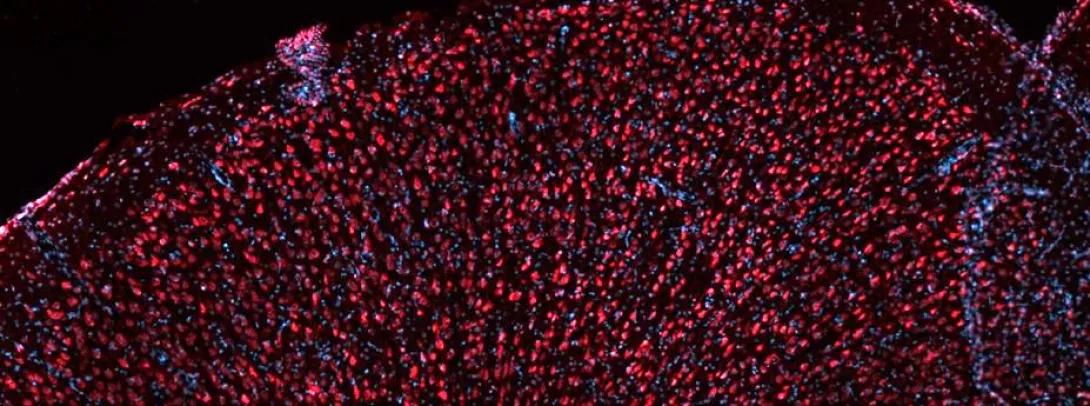 Slide scanned image of cerebral cortex.